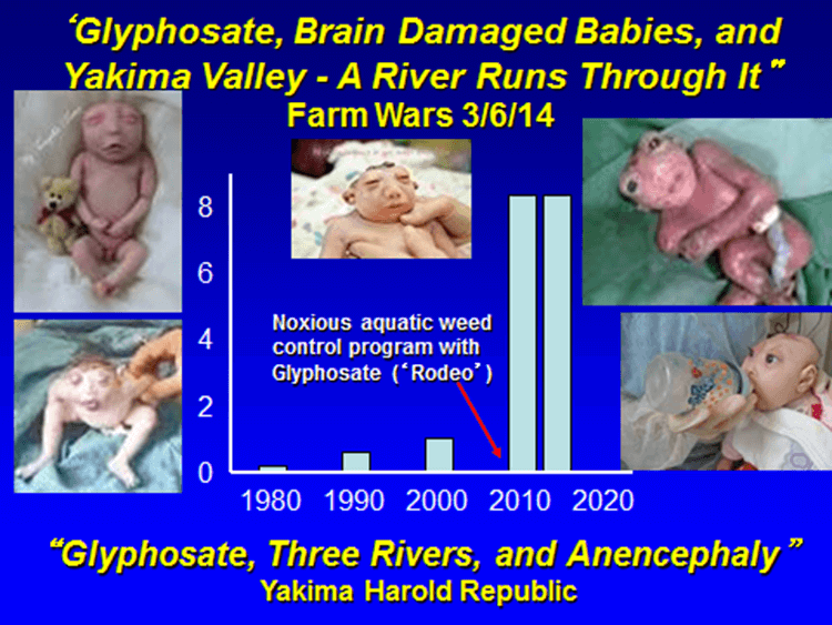 Glyphosate and brain damaged babies